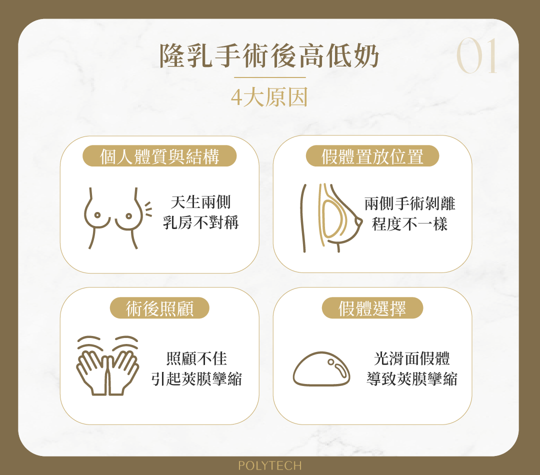 隆乳完擔心高低奶!了解高低奶4大成因與假體選擇 高低奶 四大原因