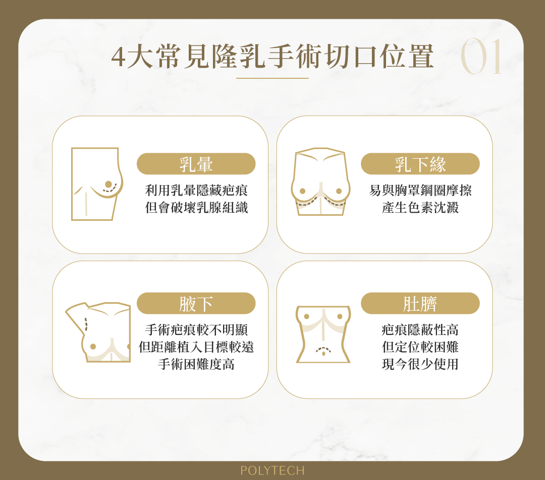 4大常見隆乳切口位置一次看懂?術後照護大不同 常見隆乳手術切口位置