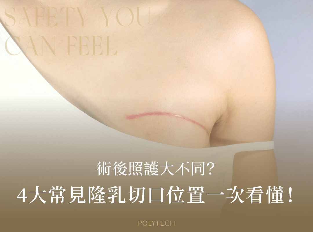 4大常見隆乳切口位置一次看懂?術後照護大不同 隆乳切口