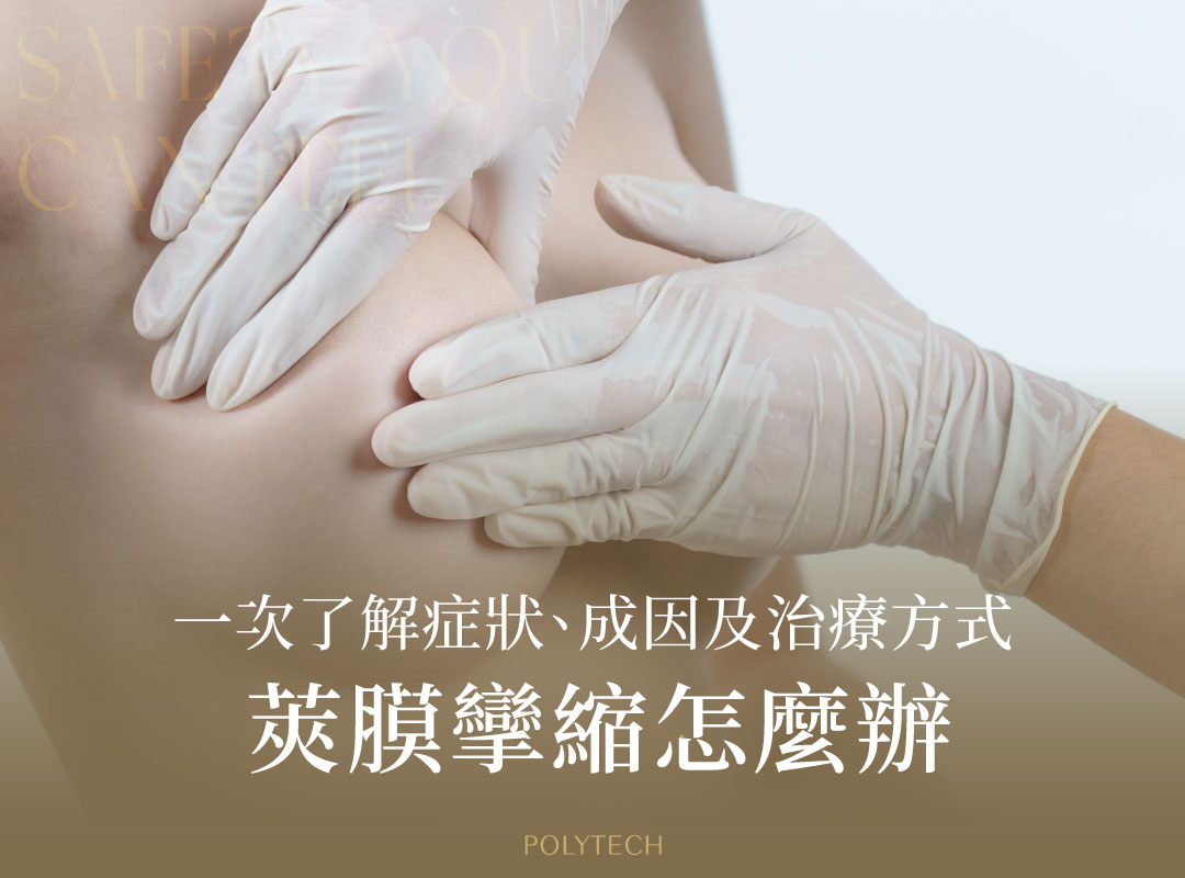 莢膜攣縮怎麼辦,從醫學分級一次了解症狀、成因以及治療方式 莢膜攣縮